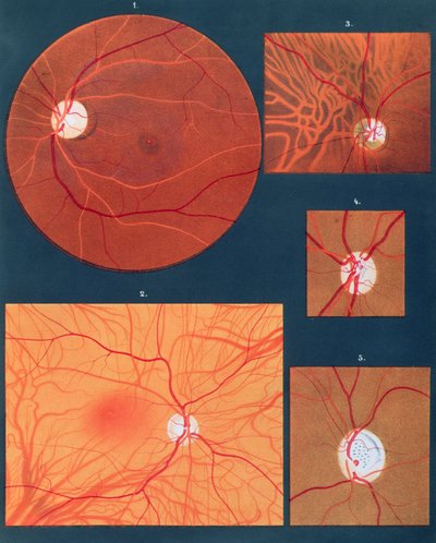 The eye seen through a microscope, from Atlas of Ophthalmoscopy, published in Paris, 1870 by Richard Liebreich